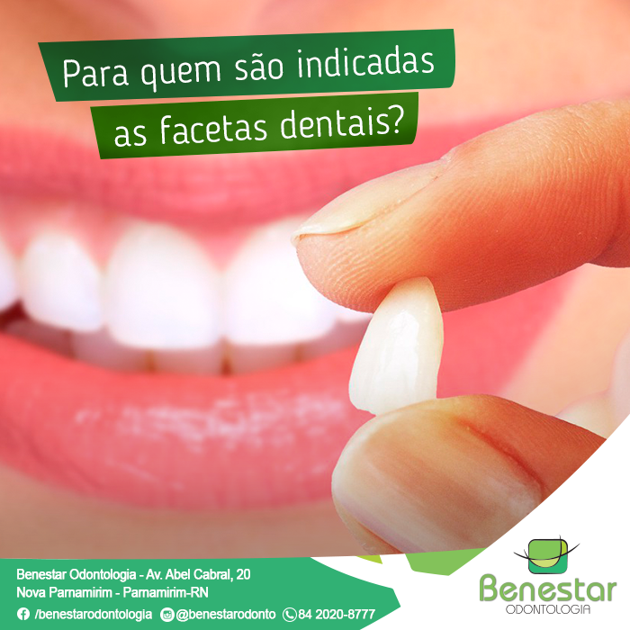 Para quem são indicadas as Facetas Dentais?