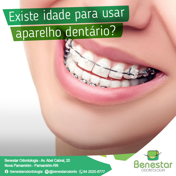 Existe idade para usar aparelho dental?