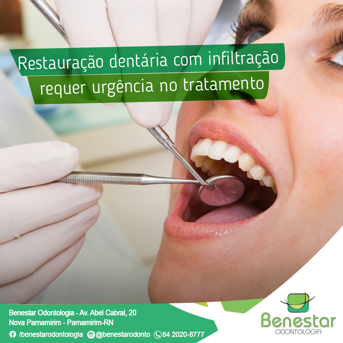 Restauração dentária com infiltração requer urgência no tratamento.