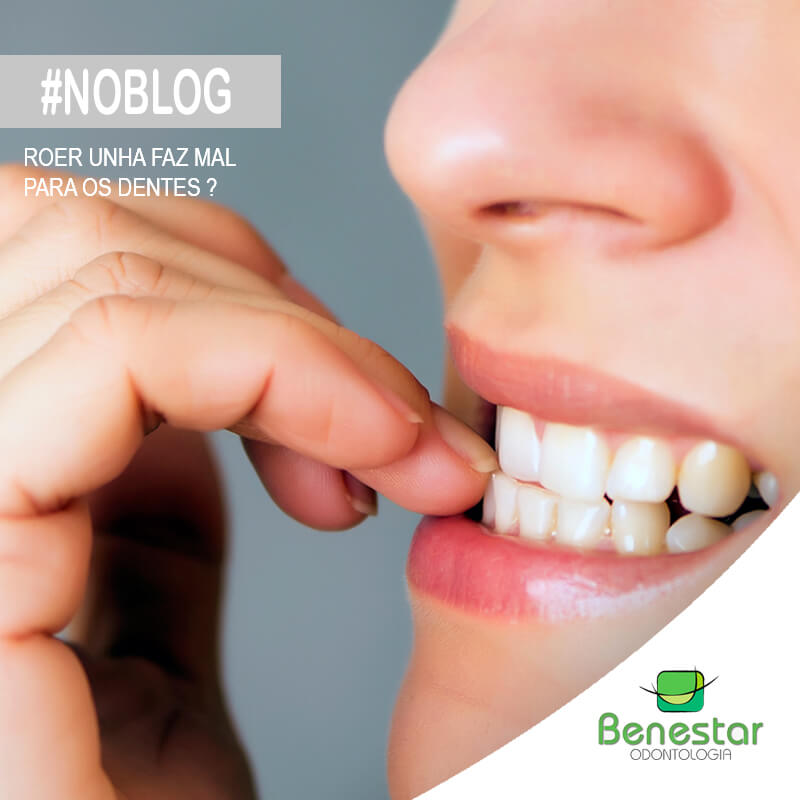 Roer unhas faz mal para os dentes