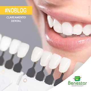 Clareamento dental